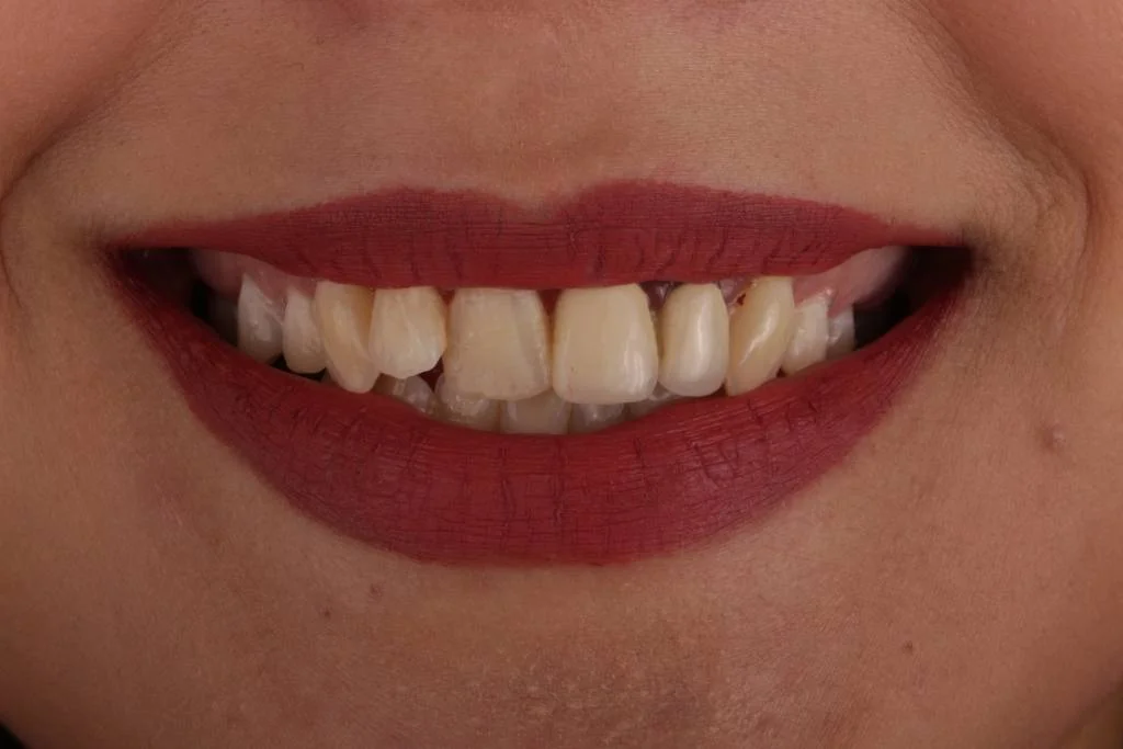 1.1before-1024x683.jpg