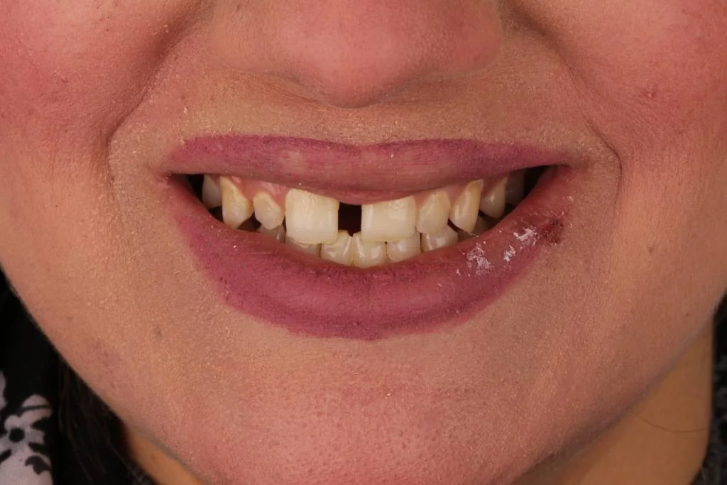 16.1before-1024x683.jpg