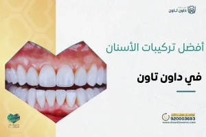 أفضل تركيبات الأسنان في داون تاون