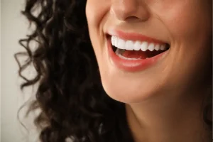 ابتسامة هوليود المتحركة سعرها
