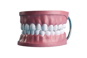 الابتسامة اللثوية وعلاجها