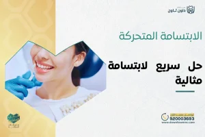الابتسامة المتحركة