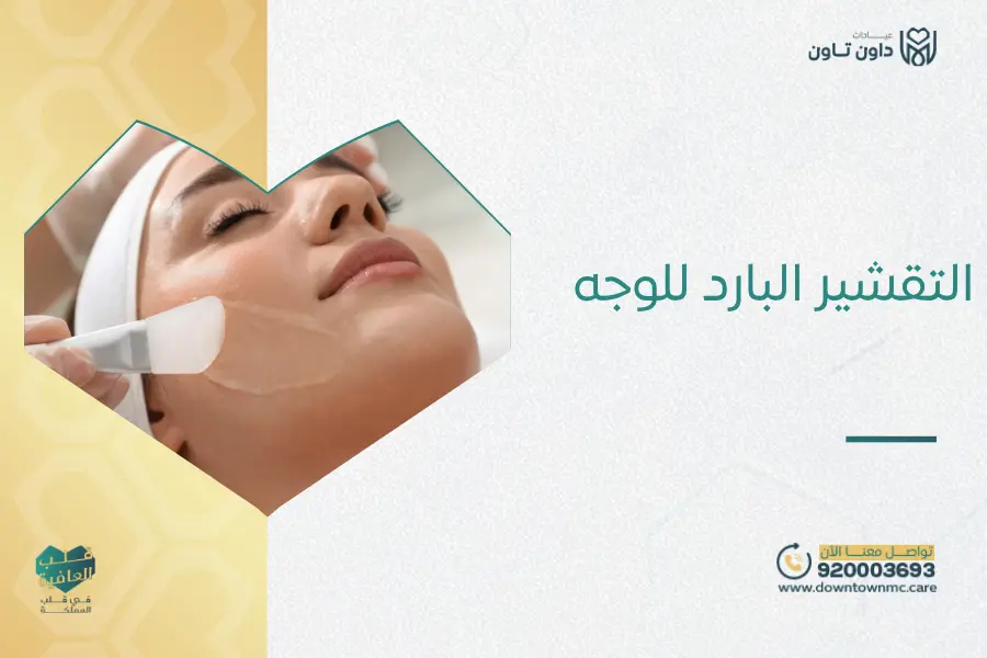 التقشير البارد للوجه