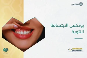 بوتكس الابتسامة اللثوية