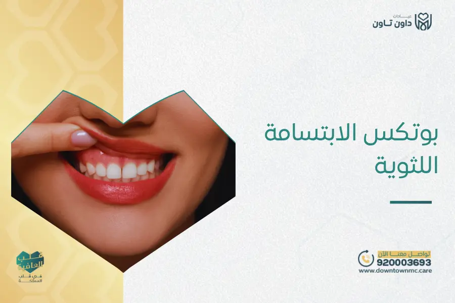 بوتكس الابتسامة اللثوية