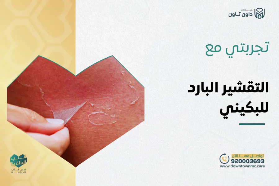 تجربتي مع التقشير البارد للبكيني
