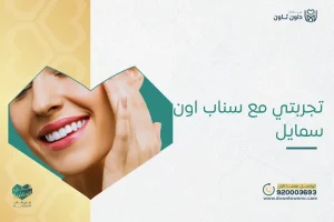 تجربتي مع سناب اون سمايل