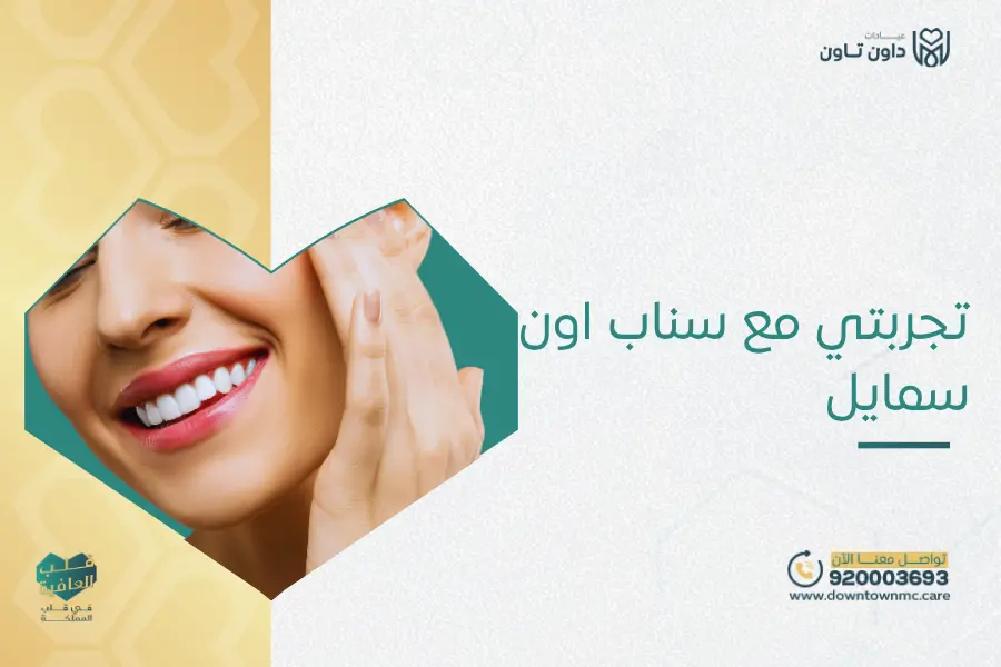 تجربتي مع سناب اون سمايل