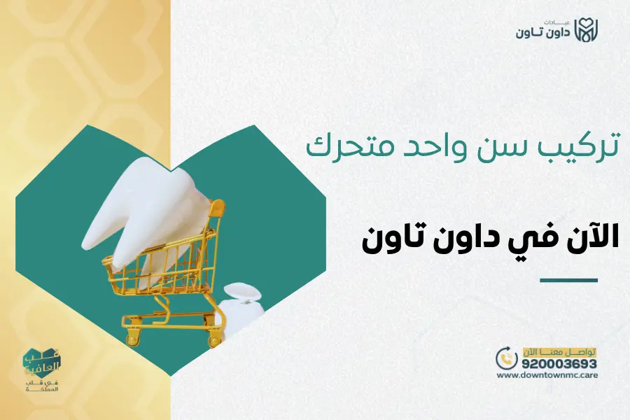 تركيب سن واحد متحرك