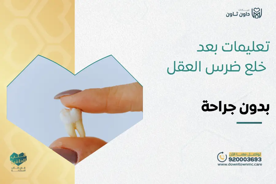 تعليمات بعد خلع ضرس العقل بدون جراحة