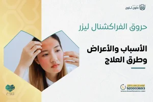 حروق الفراكشنال ليزر
