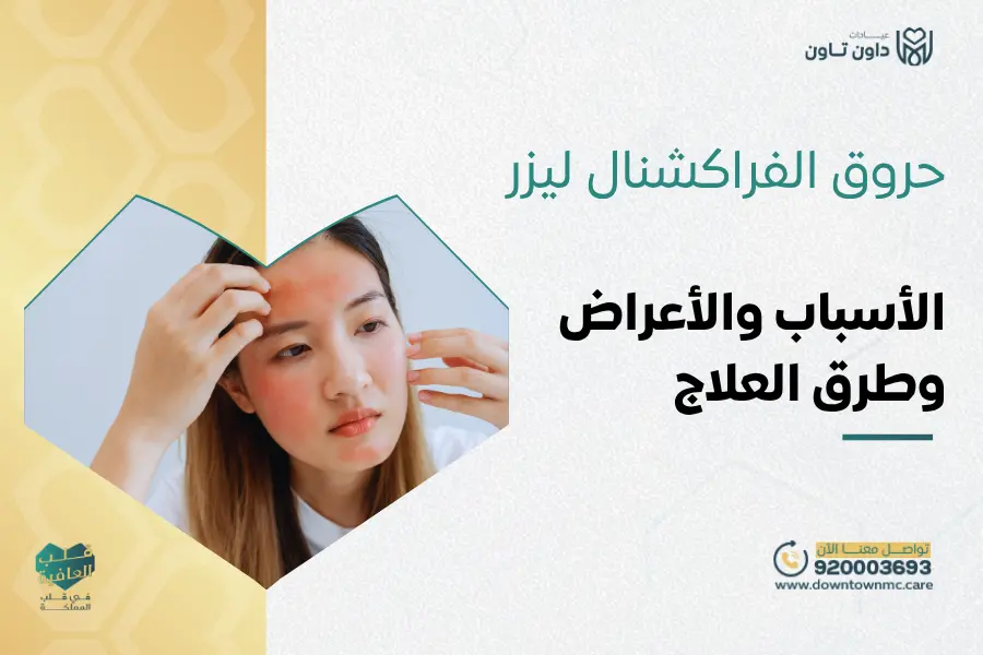 حروق الفراكشنال ليزر
