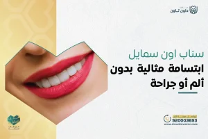سناب اون سمايل