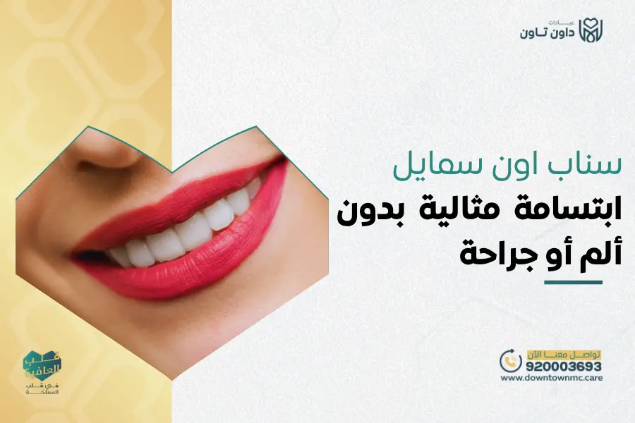 سناب اون سمايل