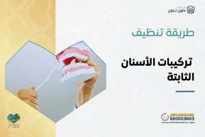 طريقة تنظيف تركيبات الأسنان الثابتة