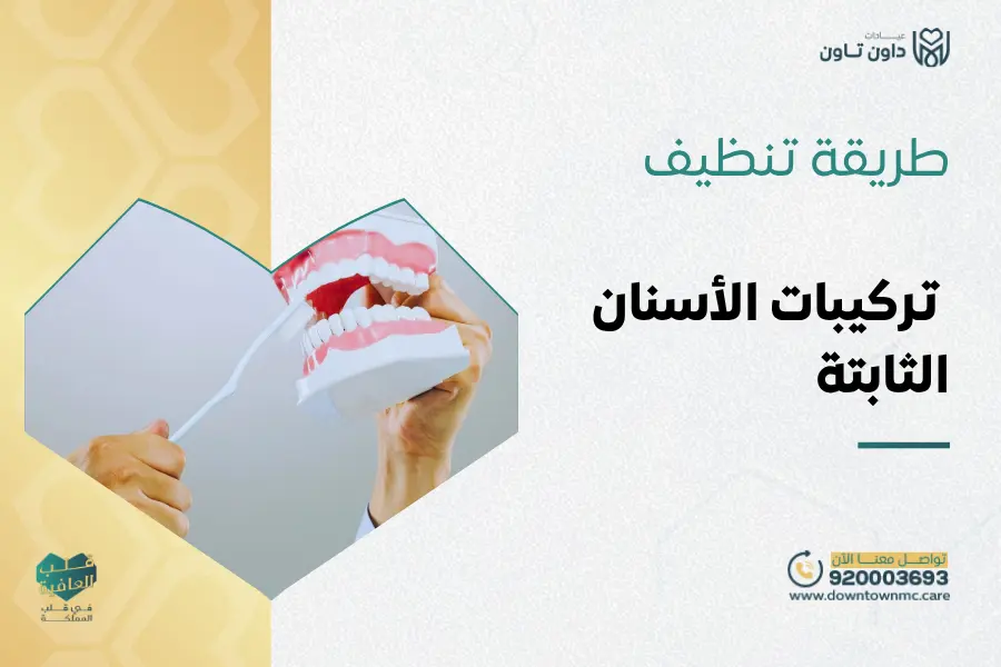 طريقة تنظيف تركيبات الأسنان الثابتة