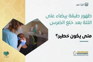 ظهور طبقة بيضاء على اللثة بعد خلع الضرس
