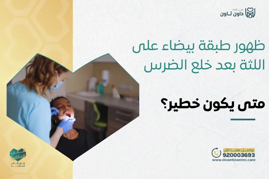 ظهور طبقة بيضاء على اللثة بعد خلع الضرس