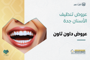 عروض تنظيف الأسنان جدة