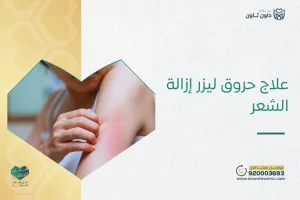 علاج حروق ليزر إزالة الشعر