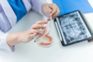 عيوب التركيبات الثابتة للأسنان