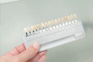 عيوب طقم الأسنان المتحرك