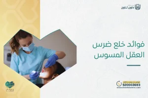 فوائد خلع ضرس العقل المسوس