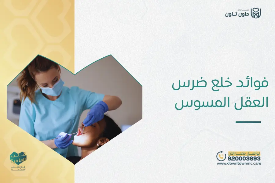 فوائد خلع ضرس العقل المسوس