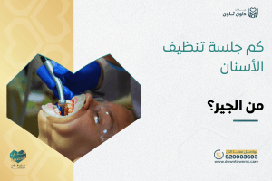 كم جلسة تنظيف الأسنان من الجير؟