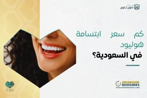 كم سعر ابتسامة هوليود في السعودية؟