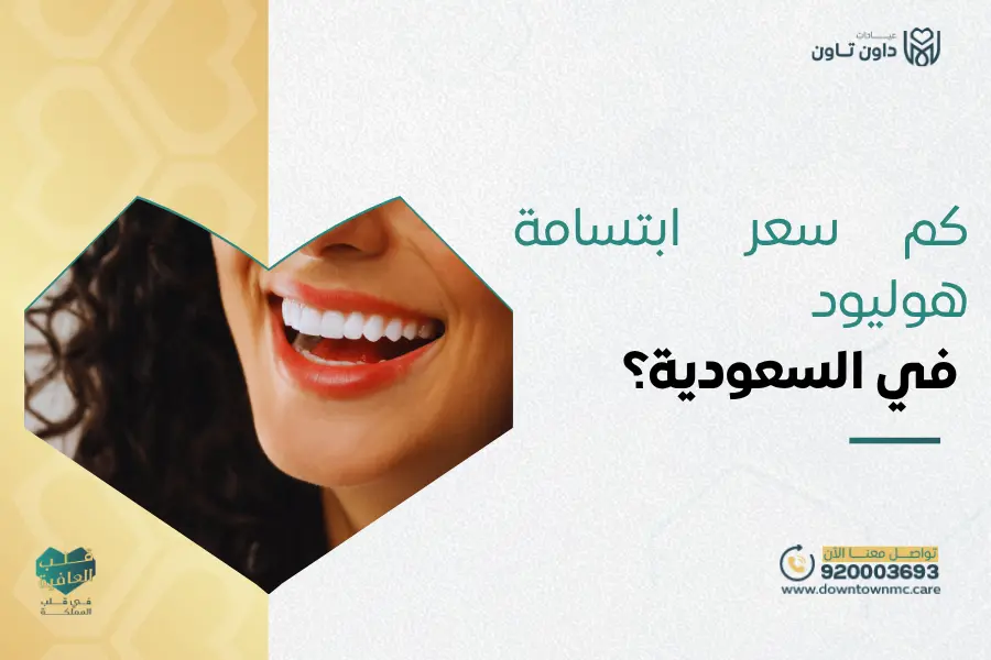 كم سعر ابتسامة هوليود في السعودية؟