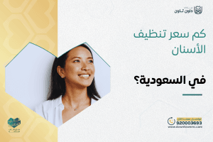 كم سعر تنظيف الأسنان في السعودية؟