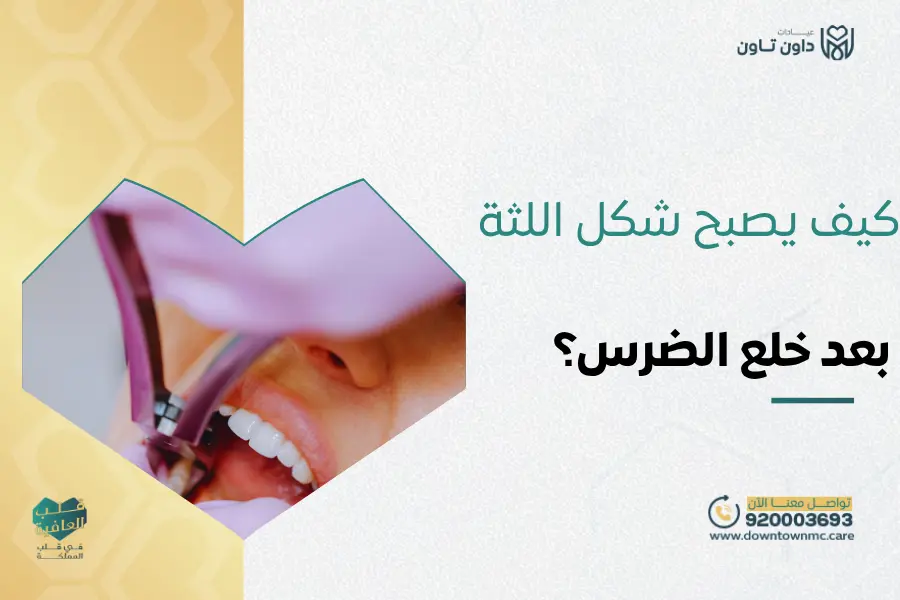 كيف يصبح شكل اللثة بعد خلع الضرس؟