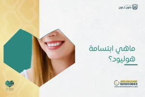 ماهي ابتسامة هوليود