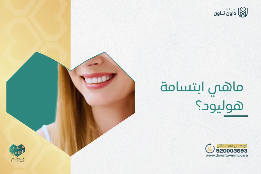 ماهي ابتسامة هوليود