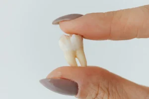 متى يخف الألم بعد خلع ضرس العقل بدون جراحة