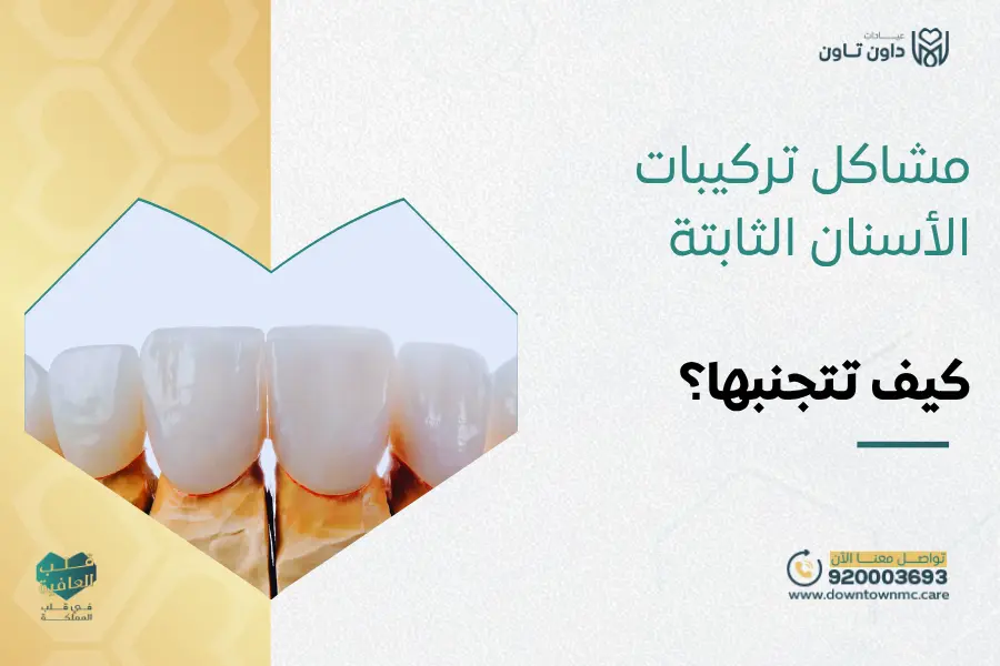 مشاكل تركيبات الأسنان الثابتة