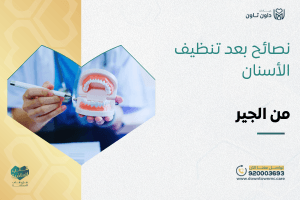 نصائح بعد تنظيف الأسنان من الجير