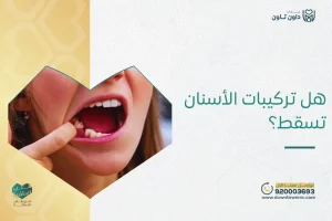 هل تركيبات الأسنان تسقط؟