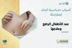 أسباب حساسية الجلد المفاجئة عند الأطفال الرضع وعلاجها​