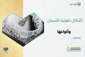 أشكال تقويم الأسنان وأنواعها