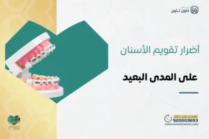 أضرار تقويم الأسنان على المدى البعيد