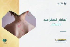 أعراض العنقز عند الأطفال​