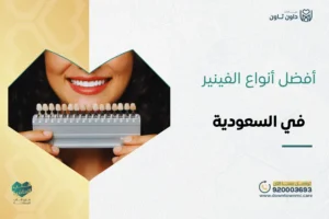 أفضل أنواع الفينير
