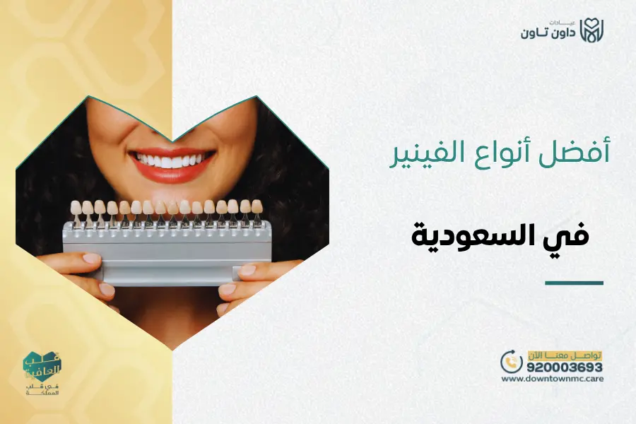 أفضل أنواع الفينير