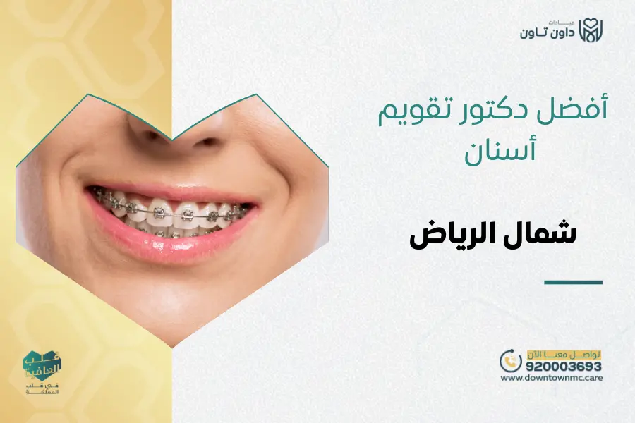 أفضل دكتور تقويم أسنان شمال الرياض