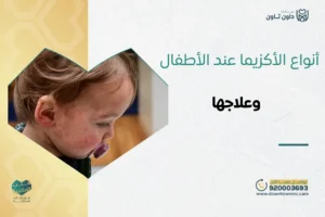 أنواع الأكزيما عند الأطفال