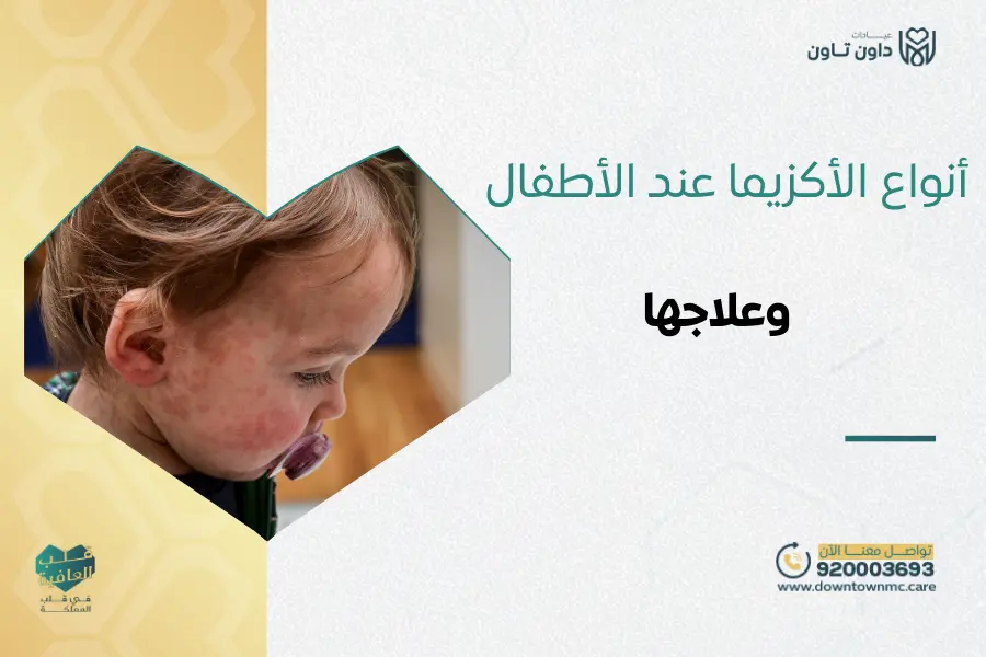أنواع الأكزيما عند الأطفال