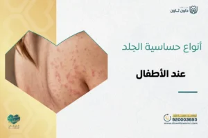 أنواع حساسية الجلد بالصور عند الأطفال​