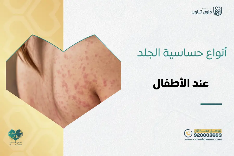 أنواع حساسية الجلد بالصور عند الأطفال
